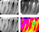 Digital Radiography image