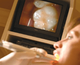 Intraoral Camera image